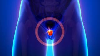 Χρόνια Προστατίτιδα: Ο εφιάλτης κάθε άνδρα ανεξαρτήτου ηλικίας. Συμβουλές από τον ειδικό