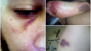 Απίστευτο περιστατικό ξυλοδαρμού στη Σαμοθράκη για ένα... τατουάζ!