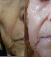 Προϊόντα Anagenessis: Προστασία των τελομερών - Το κλειδί της αντιγήρανσης στην Αλεξανδρούπολη