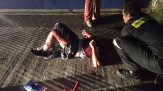 Άγρια επίθεση σκύλων σε 50χρονο - Σοβαρή η κατάστασή της υγείας του στο ΠΓΝΕ