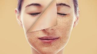 Πως διατηρούμε το δέρμα μας υγιές; Απλές συμβουλές από τον ειδικό.