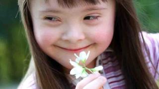 Τι πρέπει να γνωρίζουμε για τα παιδιά με σύνδρομο Down