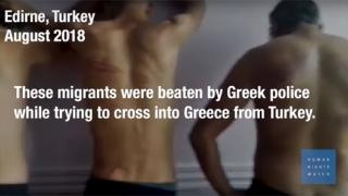 Παρατηρητήριο Ανθρωπίνων Δικαιωμάτων: «γδύσιμο, ξύλο & επαναπροωθήσεις στον Έβρο»