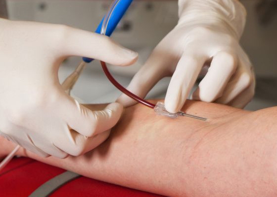 Ζητείται να λειτουργούν και απογεύματα τα κέντρα αιμοδοσίας.