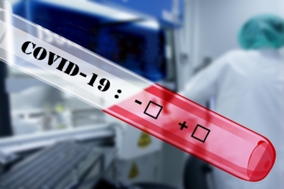 Κορoνοϊός: 2 κρούσματα στον Έβρο συνδεόμενα με γνωστή συρροή ανακοίνωσε ο ΕΟΔΥ