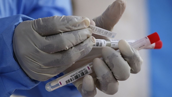 Κορονοϊός: Κλιμάκιο του ΕΟΔΥ στους Συνοριακούς Φύλακες του Έβρου - Τι έδειξαν τα αποτελέσματα